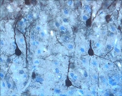 ERK1/ERK2 was detected in perfusion fixed frozen sections of rat brain (cortex) using 15 µg/mL Rabbit Anti-Human/Mouse/Rat Phospho-ERK1/ERK2 (ERK1 T202/Y204, ERK2 T185/Y187) Antigen Affinity-purified Polyclonal Antibody (Catalog # AF1018) overnight at 4 °C. Tissue was stained with the Anti-Rabbit HRP-DAB Cell & Tissue Staining Kit (brown; Catalog # CTS005) and counterstained with hematoxylin (blue). View our protocol for Chromogenic IHC Staining of Frozen Tissue Sections.