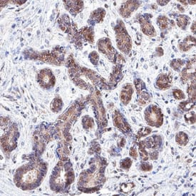 ERK2 was detected in immersion fixed paraffin-embedded sections of human breast using Goat Anti-Human/Mouse/Rat ERK2 Antigen Affinity-purified Polyclonal Antibody (Catalog # AF12301) at 3 µg/mL for 1 hour at room temperature followed by incubation with the Anti-Goat IgG VisUCyte™ HRP Polymer Antibody (Catalog # VC004). Tissue was stained using DAB (brown) and counterstained with hematoxylin (blue). Specific staining was localized to cytoplasm in epithelial cells. View our protocol for IHC Staining with VisUCyte HRP Polymer Detection Reagents.