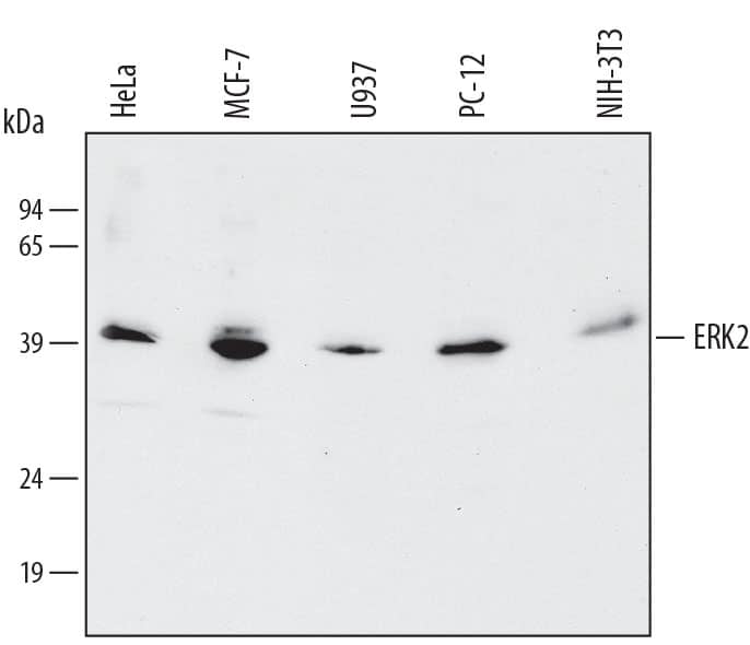 Western Blot ERK2 Antibody [Unconjugated]