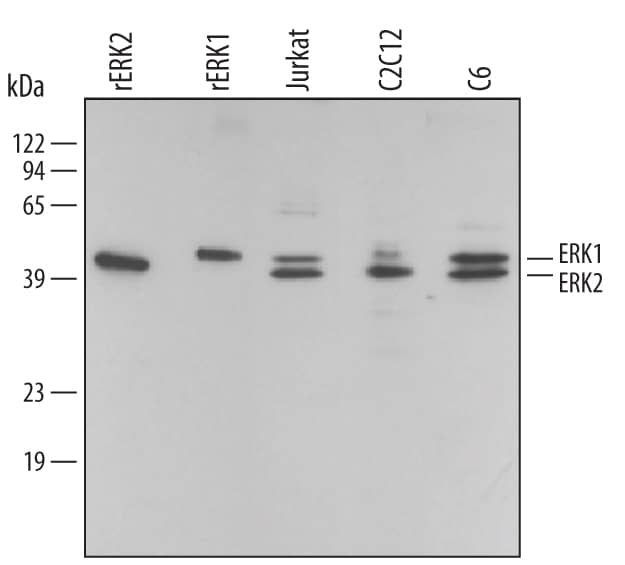 Western blot shows lysates of Jurkat human acute T cell leukemia cell line, C2C12 mouse myoblast cell line myoblast cell line, and C6 rat glioma cell line. PVDF membrane was probed with 0.2 µg/mL Rabbit Anti-Human/Mouse/Rat ERK1/ERK2 Antigen Affinity-purified Polyclonal Antibody (Catalog # AF1576) followed by HRP-conjugated Anti-Rabbit IgG Secondary Antibody (Catalog # HAF008). For additional reference, Recombinant Human Active ERK1 (Catalog # 1879-KS) and Recombinant Human Active ERK2 (Catalog # 1230-KS) (2 ng/lane) were included. A specific band for ERK1/ERK2 was detected at approximately 44 kDa (as indicated). This experiment was conducted under reducing conditions and using Immunoblot Buffer Group 1.