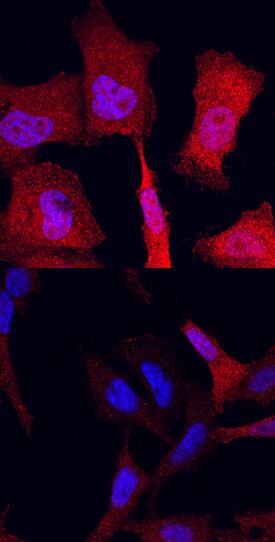 <b>Biological Strategies Validation. </b>ERK1/ERK2 phosphorylated at T202/Y204 (ERK1) and T185/Y187 (ERK2) was detected in immersion fixed Hela human cervical epithelial carcinoma cells, unstimulated (lower panel) and stimulated (upper panel) with PMA using Rabbit Anti-Human/Mouse/Rat Phospho-ERK1/ERK2 (ERK1 T202/Y204, ERK2 T185/Y187) Monoclonal Antibody (Catalog # MAB1018) at 10 µg/mL for 3 hours at room temperature. Cells were stained using the NorthernLights™ 557-conjugated Anti-Rabbit IgG Secondary Antibody (red; Catalog # NL004) and counterstained with DAPI (blue). Specific staining was localized to cytoplasm. View our protocol for Fluorescent ICC Staining of Cells on Coverslips.