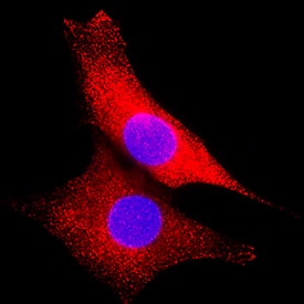 ERK2 was detected in immersion fixed 3T3-L1 mouse embryonic fibroblast adipose-like cell line using Mouse Anti-Human/Mouse/Rat ERK2 Monoclonal Antibody (Catalog # MAB1230) at 3 µg/mL for 3 hours at room temperature. Cells were stained using the NorthernLights™ 557-conjugated Anti-Mouse IgG Secondary Antibody (red; Catalog # NL007) and counterstained with DAPI (blue). Specific staining was localized to cytoplasm and nuclei. View our protocol for Fluorescent ICC Staining of Cells on Coverslips.