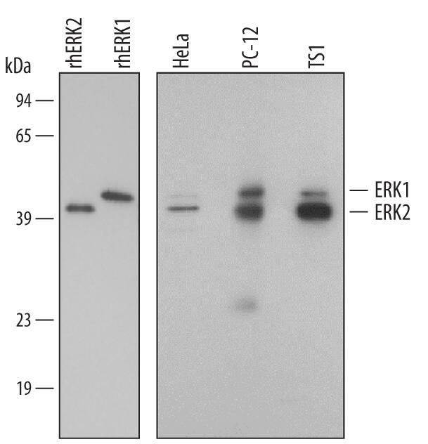 Western blot shows lysates of HeLa human cervical epithelial carcinoma cell line, PC-12 rat adrenal pheochromocytoma cell line, and TS1 mouse helper T cell line. PVDF membrane was probed with 0.5 µg/mL Mouse Anti-Human/Mouse/Rat ERK1/ERK2 Monoclonal Antibody (Catalog # MAB1576) followed by HRP-conjugated Anti-Mouse IgG Secondary Antibody (Catalog # HAF007). For additional reference, recombinant human ERK1 and ERK2 (2 ng/lane) were included. A specific band for ERK1/ERK2 was detected at approximately 44/42 kDa (as indicated). This experiment was conducted under reducing conditions and using Immunoblot Buffer Group 4.