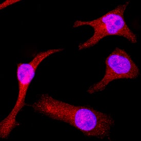 Immunocytochemistry ERK5/BMK1 Antibody [Unconjugated]