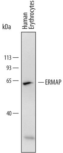Western blot shows lysates of human erythrocytes. PVDF membrane was probed with 2 µg/mL of Mouse Anti-Human ERMAP Monoclonal Antibody (Catalog # MAB4928) followed by HRP-conjugated Anti-Mouse IgG Secondary Antibody (Catalog # HAF018). A specific band was detected for ERMAP at approximately 63 kDa (as indicated). This experiment was conducted under reducing conditions and using Immunoblot Buffer Group 1.