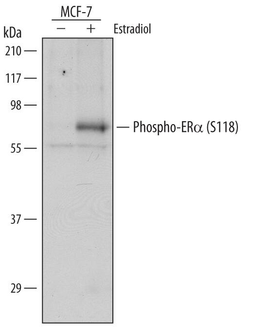 Western blot shows lysates of MCF-7 human breast cancer cell line untreated (-) or treated (+) with 100 nM estradiol for 60 minutes. PVDF Membrane was probed with 1 µg/mL of Rabbit Anti-Human Phospho-ERa/NR3A1 (S118) Antigen Affinity-purified Polyclonal Antibody (Catalog # AF5954) followed by HRP-conjugated Anti-Rabbit IgG Secondary Antibody (Catalog # HAF008). A specific band was detected for Phospho-ERa/NR3A1 (S118) at approximately 65 kDa (as indicated). This experiment was conducted under reducing conditions and using Immunoblot Buffer Group 2.