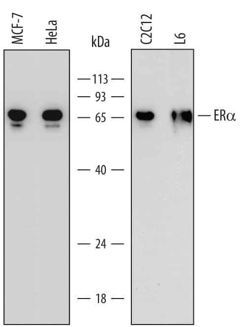 Western Blot ER alpha/NR3A1 Antibody (681118)