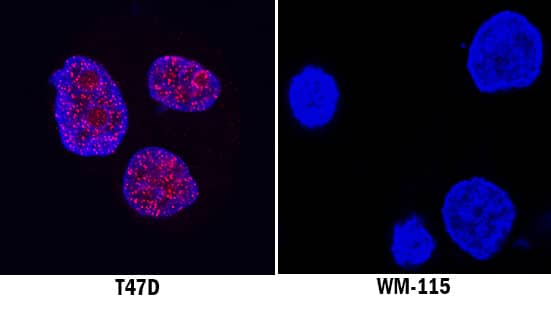 ERa/NR3A1 was detected in immersion fixed T47D human breast cancer cell line (positive stain) and WM-115 human malignant melanoma cell line (negative stain) using Rabbit Anti-Human ERa/NR3A1 Monoclonal Antibody (Catalog # MAB57153) at 3 µg/mL for 3 hours at room temperature. Cells were stained using the NorthernLights™ 557-conjugated Anti-Rabbit IgG Secondary Antibody (red; Catalog # NL004) and counterstained with DAPI (blue). Specific staining was localized to cell nuclei. View our protocol for Fluorescent ICC Staining of Cells on Coverslips.