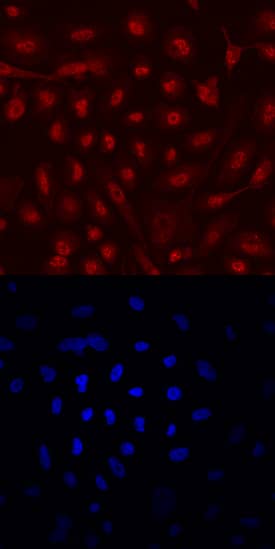 ERa/NR3A1 was detected in immersion fixed PC-3 human prostate cancer cell line using Mouse Anti-Human ERa/NR3A1 Monoclonal Antibody (Catalog # MAB5715) at 10 µg/mL for 3 hours at room temperature. Cells were stained using the Northern-Lights™ 557-conjugated Anti-Mouse IgG Secondary Antibody (red, upper panel; Catalog # NL007) and counter-stained with DAPI (blue, lower panel). Specific staining was localized to nuclei. View our protocol for Fluorescent ICC Staining of Cells on Coverslips.