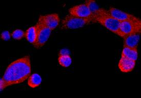 ER beta /NR3A2 was detected in immersion fixed LNCaP human prostate cancer cell line using Mouse Anti-Human ER beta /NR3A2 Monoclonal Antibody (Catalog # MAB7106) at 10 µg/mL for 3 hours at room temperature. Cells were stained using the NorthernLights™ 557-conjugated Anti-Mouse IgG Secondary Antibody (red; Catalog # NL007) and counter-stained with DAPI (blue). Specific staining was localized to cytoplasm. View our protocol for Fluorescent ICC Staining of Cells on Coverslips.