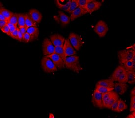 ER beta /NR3A2 was detected in immersion fixed MCF-7 human breast cancer cell line using Mouse Anti-Human ER beta /NR3A2 Monoclonal Antibody (Catalog # MAB7106) at 10 µg/mL for 3 hours at room temperature. Cells were stained using the NorthernLights™ 557-conjugated Anti-Mouse IgG Secondary Antibody (red; Catalog # NL007) and counter-stained with DAPI (blue). Specific staining was localized to cytoplasm and nuclei. View our protocol for Fluorescent ICC Staining of Cells on Coverslips.