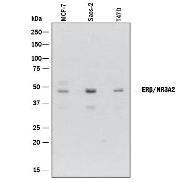 Western blot shows lysates of MCF-7 human breast cancer cell line, Saos-2 human osteosarcoma cell line, and T47D human breast cancer cell line. PVDF membrane was probed with 2 µg/mL of Mouse Anti-Human ER beta /NR3A2 Monoclonal Antibody (Catalog # MAB7106) followed by HRP-conjugated Anti-Mouse IgG Secondary Antibody (Catalog # HAF007). A specific band was detected for ER beta /NR3A2 at approximately 48 kDa (as indicated). This experiment was conducted under reducing conditions and using Immunoblot Buffer Group 1.