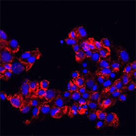 E-Selectin/CD62E was detected in immersion fixed HUVEC human umbilical vein endothelial cells stimulated with Recombinant Human TNF-alpha (Catalog # 210-TA) using Mouse Anti-Human E-Selectin/CD62E Monoclonal Antibody (Catalog # BBA26) at 5 µg/mL for 3 hours at room temperature. Cells were stained using the NorthernLights™ 557-conjugated Anti-Mouse IgG Secondary Antibody (red; Catalog # NL007) and counterstained with DAPI (blue). Specific staining was localized to cytoplasm. View our protocol for Fluorescent ICC Staining of Cells on Coverslips.