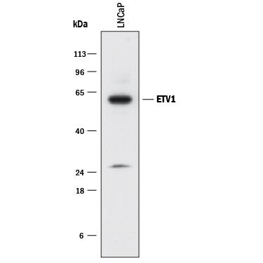 Western blot shows lysates of LNCaP human prostate cancer cell line. PVDF membrane was probed with 2 µg/mL of Mouse Anti-Human ETV1 Monoclonal Antibody (Catalog # MAB9389) followed by HRP-conjugated Anti-Mouse IgG Secondary Antibody (Catalog # HAF018). A specific band was detected for ETV1 at approximately 60 kDa (as indicated). This experiment was conducted under reducing conditions and using Immunoblot Buffer Group 1.
