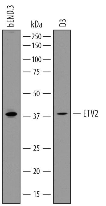 Western Blot ETV2/ER71 Antibody (827940)
