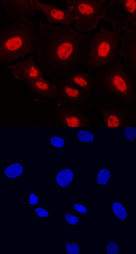 ETV5 was detected in immersion fixed BT-20 human breast cancer cell line using Mouse Anti-Human ETV5 Monoclonal Antibody (Catalog # MAB7107) at 10 µg/mL for 3 hours at room temperature. Cells were stained using the NorthernLights™ 557-conjugated Anti-Mouse IgG Secondary Antibody (red, upper panel; Catalog # NL007) and counterstained with DAPI (blue, lower panel). Specific staining was localized to nuclei. View our protocol for Fluorescent ICC Staining of Cells on Coverslips.