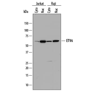 Western blot shows lysates of Jurkat human acute T cell leukemia cell line and Raji human Burkitt's lymphoma cell line. Gels were loaded with 30 µg of cytoplasmic (Cyto) and 15 µg of nuclear (Nuc) extracts. PVDF membrane was probed with 1 µg/mL of Sheep Anti-Human ETV6 Antigen Affinity-purified Polyclonal Antibody (Catalog # AF7945) followed by HRP-conjugated Anti-Sheep IgG Secondary Antibody (Catalog # HAF016). A specific band was detected for ETV6 at approximately 60 kDa (as indicated). This experiment was conducted under reducing conditions and using Immunoblot Buffer Group 1.