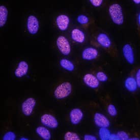 EVI-1 was detected in immersion fixed SK-OV-3 human ovarian adenocarcinoma cell line using Mouse Anti-Human EVI-1 Monoclonal Antibody (Catalog # MAB75061) at 10 µg/mL for 3 hours at room temperature. Cells were stained using the NorthernLights™ 557-conjugated Anti-Mouse IgG Secondary Antibody (red; Catalog # NL007) and counterstained with DAPI (blue). Specific staining was localized to nuclei. View our protocol for Fluorescent ICC Staining of Cells on Coverslips.
