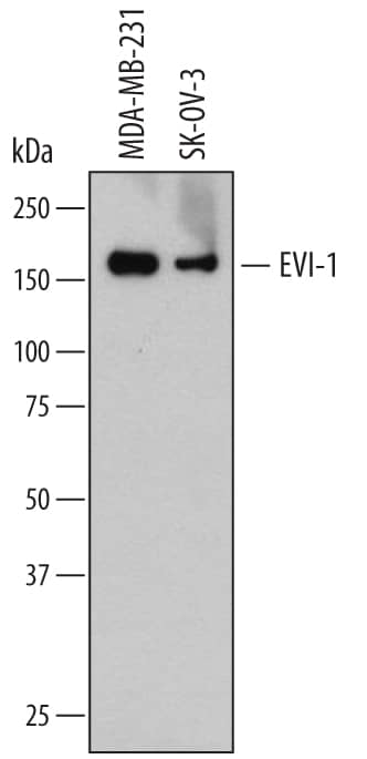 Western blot shows lysates of MDA-MB-231 human breast cancer cell line and SK-OV-3 human ovarian adenocarcinoma cell line. PVDF membrane was probed with 2 µg/mL of Mouse Anti-Human EVI-1 Monoclonal Antibody (Catalog # MAB7506) followed by HRP-conjugated Anti-Mouse IgG Secondary Antibody (Catalog # HAF007). A specific band was detected for EVI-1 at approximately 190 kDa (as indicated). This experiment was conducted under reducing conditions and using Immunoblot Buffer Group 1.