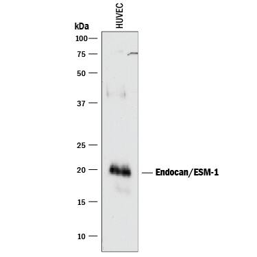 Western blot shows lysate of HUVEC human umbilical vein endothelial cells. PVDF membrane was probed with 1 µg/mL of Goat Anti-Human Endocan/ESM-1 Antigen Affinity-purified Polyclonal Antibody (Catalog # AF1810) followed by HRP-conjugated Anti-Goat IgG Secondary Antibody (Catalog # HAF017). A specific band was detected for Endocan/ESM-1 at approximately 20 kDa (as indicated). This experiment was conducted under reducing conditions and using Immunoblot Buffer Group 1.