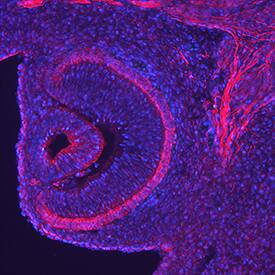 Endocan/ESM-1 was detected in perfusion fixed frozen sections of mouse embryo (13 d.p.c.) using Goat Anti-Mouse Endocan/ESM-1 Antigen Affinity-purified Polyclonal Antibody (Catalog # AF1999) at 5 µg/mL overnight at 4 °C. Tissue was stained using the NorthernLights™ 557-conjugated Anti-Goat IgG Secondary Antibody (red; Catalog # NL001) and counterstained with DAPI (blue). Specific staining was localized to the retina. View our protocol for Fluorescent IHC Staining of Frozen Tissue Sections.