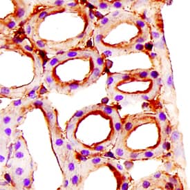 Immunohistochemistry Endoglin/CD105 Antibody [Unconjugated]