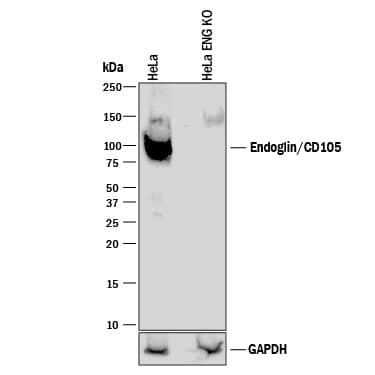 Knockout Validated Endoglin/CD105 Antibody [Unconjugated]