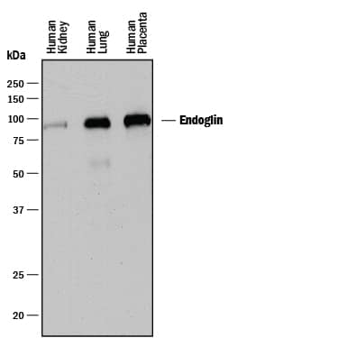 Western Blot Endoglin/CD105 Antibody [Unconjugated]