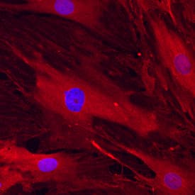 Immunocytochemistry Endoglin/CD105 Antibody [Unconjugated]