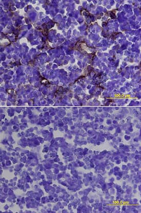 Immunohistochemistry Endoglin/CD105 Antibody [Unconjugated]