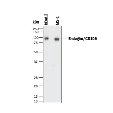 Western Blot Endoglin/CD105 Antibody [Unconjugated]
