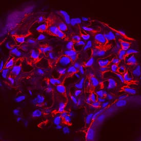 Endoglin/CD105 was detected in perfusion fixed frozen sections of rat kidney using Goat Anti-Rat Endoglin/CD105 Antigen Affinity-purified Polyclonal Antibody (Catalog # AF6440) at 1 µg/mL overnight at 4 °C. Tissue was stained using the NorthernLights™ 557-conjugated Anti-Goat IgG Secondary Antibody (red; Catalog # NL001) and counterstained with DAPI (blue). Specific staining was localized to endothelial cells in glomeruli. View our protocol for Fluorescent IHC Staining of Frozen Tissue Sections.