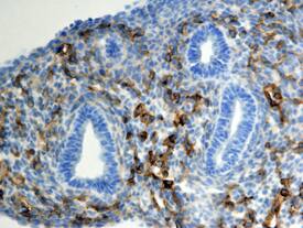 Endoglin/CD105 was detected in immersion fixed frozen sections of mouse lung using 15 µg/mL Goat Anti-Mouse Endoglin/CD105 Biotinylated Antigen Affinity-purified Poly-clonal Antibody (Catalog # BAF1320) overnight at 4 °C. Tissue was stained with the Anti-Goat HRP-DAB Cell & Tissue Staining Kit (brown; Catalog # CTS008) and counterstained with hematoxylin (blue). View our protocol for Chromogenic IHC Staining of Frozen Tissue Sections.