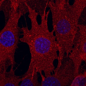 Immunocytochemistry Endoglin/CD105 Antibody (209701) [Unconjugated]