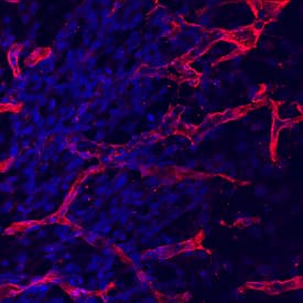 Immunohistochemistry Endoglin/CD105 Antibody (209701) [Unconjugated]