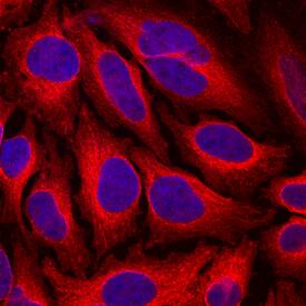 Endoglycan/PODXL2 was detected in immersion fixed HeLa human cervical epithelial carcinoma cell line using Mouse Anti-Human Endoglycan/PODXL2 Monoclonal Antibody (Catalog # MAB1524) at 10 µg/mL for 3 hours at room temperature. Cells were stained using the NorthernLights™ 557-conjugated Anti-Mouse IgG Secondary Antibody (red; Catalog # NL007) and counterstained with DAPI (blue). Specific staining was localized to cytoplasm. View our protocol for Fluorescent ICC Staining of Cells on Coverslips.