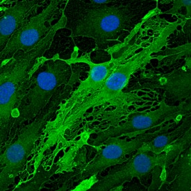 Immunocytochemistry Endomucin/Mucin -14 Antibody [Unconjugated]
