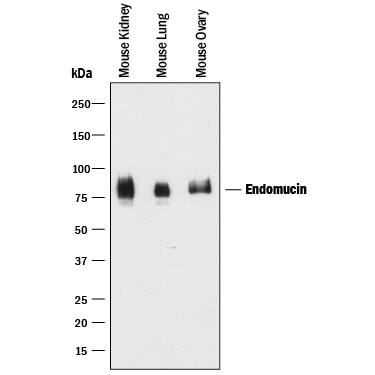 Western Blot Endomucin/Mucin -14 Antibody [Unconjugated]