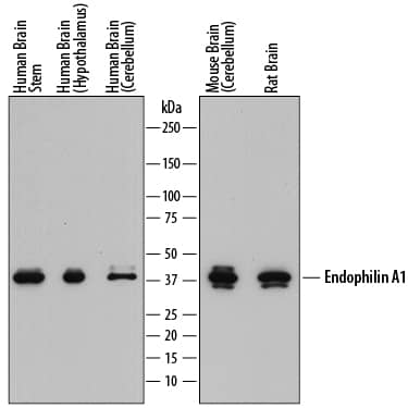 Western blot shows lysates of human brain stem tissue, human brain (hypothalamus) tissue, human brain (cerebellum) tissue, mouse brain (cerebellum) tissue, and rat brain tissue. PVDF membrane was probed with 1 µg/mL of Sheep Anti-Human Endophilin A1/SH3GL2 Antigen Affinity-purified Polyclonal Antibody (Catalog # AF8006) followed by HRP-conjugated Anti-Sheep IgG Secondary Antibody (Catalog # HAF016). A specific band was detected for Endophilin A1/SH3GL2 at approximately 40 kDa (as indicated). This experiment was conducted under reducing conditions and using Immunoblot Buffer Group 1.