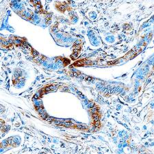 Immunohistochemistry Endophilin B1/Bif-1 Antibody [Unconjugated]