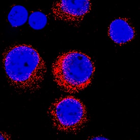 Endophilin B1/B2 was detected in immersion fixed Jurkat human acute T cell leukemia cell line using Mouse Anti-Human Endophilin B1/B2 Monoclonal Antibody (Catalog # MAB7456) at 8 µg/mL for 3 hours at room temperature. Cells were stained using the NorthernLights™ 557-conjugated Anti-Mouse IgG Secondary Antibody (red; Catalog # NL007) and counterstained with DAPI (blue). Specific staining was localized to cytoplasm. View our protocol for Fluorescent ICC Staining of Non-adherent Cells.