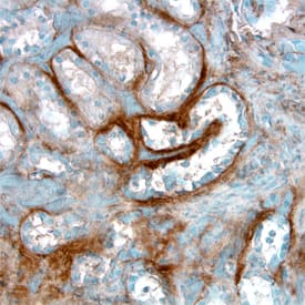 Endostatin was detected in immersion fixed paraffin-embedded sections of human kidney using Goat Anti-Human Endostatin Antigen Affinity-purified Polyclonal Antibody (Catalog # AF1098) at 5 &micro;g/mL overnight at 4 &deg;C. Tissue was stained using the Anti-Goat HRP-DAB Cell & Tissue Staining Kit (brown; Catalog # CTS008) and counterstained with hematoxylin (blue). View our protocol for Chromogenic IHC Staining of immersion fixed paraffin-embedded Tissue Sections.
