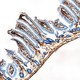 Endostatin was detected in perfusion fixed frozen sections of mouse intestine using Goat Anti-Mouse Endostatin Antigen Affinity-purified Polyclonal Antibody (Catalog # AF570) at 1.7 µg/mL overnight at 4 °C. Tissue was stained using the Anti-Goat HRP-DAB Cell & Tissue Staining Kit (brown; Catalog # CTS008) and counterstained with hematoxylin (blue). Specific staining was localized to lacteals. View our protocol for Chromogenic IHC Staining of Frozen Tissue Sections.