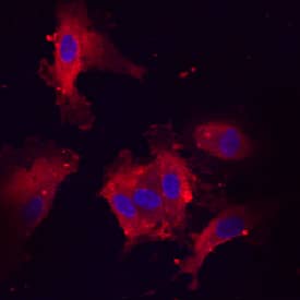 Endothelin-1 was detected in immersion fixed HUVEC human umbilical vein endothelial cells using Rat Anti-Human Endothelin-1 C-Terminus Monoclonal Antibody (Catalog # MAB3440) at 10 µg/mL for 3 hours at room temperature. Cells were stained using the NorthernLights™ 557-conjugated Anti-Rat IgG Secondary Antibody (red; Catalog # NL013) and counterstained with DAPI (blue). View our protocol for Fluorescent ICC Staining of Cells on Coverslips.