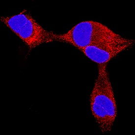 Endothelin-3 was detected in immersion fixed LNCaP human prostate cancer cell line using Mouse Anti-Human Endothelin-3 Monoclonal Antibody (Catalog # MAB5579) at 25 µg/mL for 3 hours at room temperature. Cells were stained using the NorthernLights™ 557-conjugated Anti-Mouse IgG Secondary Antibody (red; Catalog # NL007) and counterstained with DAPI (blue). Specific staining was localized to cell secretion. View our protocol for Fluorescent ICC Staining of Cells on Coverslips.