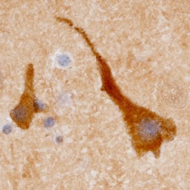 Immunohistochemistry Enolase 2/Neuron-specific Enolase Antibody [Unconjugated]