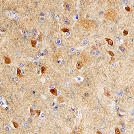 Immunohistochemistry Enolase 2/Neuron-specific Enolase Antibody [Unconjugated]