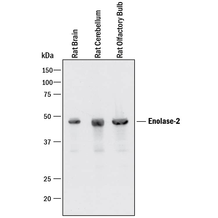 Western Blot Enolase 2/Neuron-specific Enolase Antibody [Unconjugated]