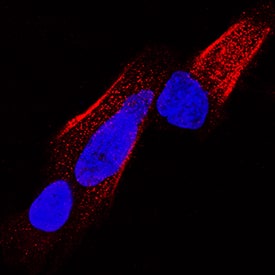 Enolase 2/Neuron-specific Enolase was detected in immersion fixed SH-SY5Y human neuroblastoma cell line using Mouse Anti-Human Enolase 2/Neuron-specific Enolase Monoclonal Antibody (Catalog # MAB51691) at 1 µg/mL for 3 hours at room temperature. Cells were stained using the NorthernLights™ 557-conjugated Anti-Mouse IgG Secondary Antibody (red; Catalog # NL007) and counterstained with DAPI (blue). Specific staining was localized to cytoplasm and plasma membrane. View our protocol for Fluorescent ICC Staining of Cells on Coverslips.