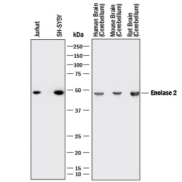 Western blot shows lysates of Jurkat human acute T cell leukemia cell line, SH-SY5Y human neuroblastoma cell line, human brain tissue (cerebellum), mouse brain tissue (cerebellum), and rat brain tissue (cerebellum). PVDF membrane was probed with 0.5 µg/mL of Mouse Anti-Human Enolase 2/Neuron-specific Enolase Monoclonal Antibody (Catalog # MAB51691) followed by HRP-conjugated Anti-Mouse IgG Secondary Antibody (Catalog # HAF018). A specific band was detected for Enolase 2/Neuron-specific Enolase at approximately 47 kDa (as indicated). This experiment was conducted under reducing conditions and using Immunoblot Buffer Group 1.